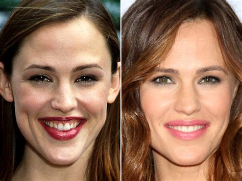 jennifer garner boobs|Jennifer Garner Before and After Plastic Surgery